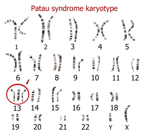 01 patau vien cong nghe dna