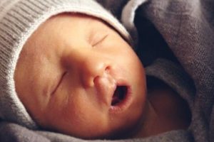 Hội chứng Edwards là gì?