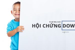 Hội chứng Down là gì?