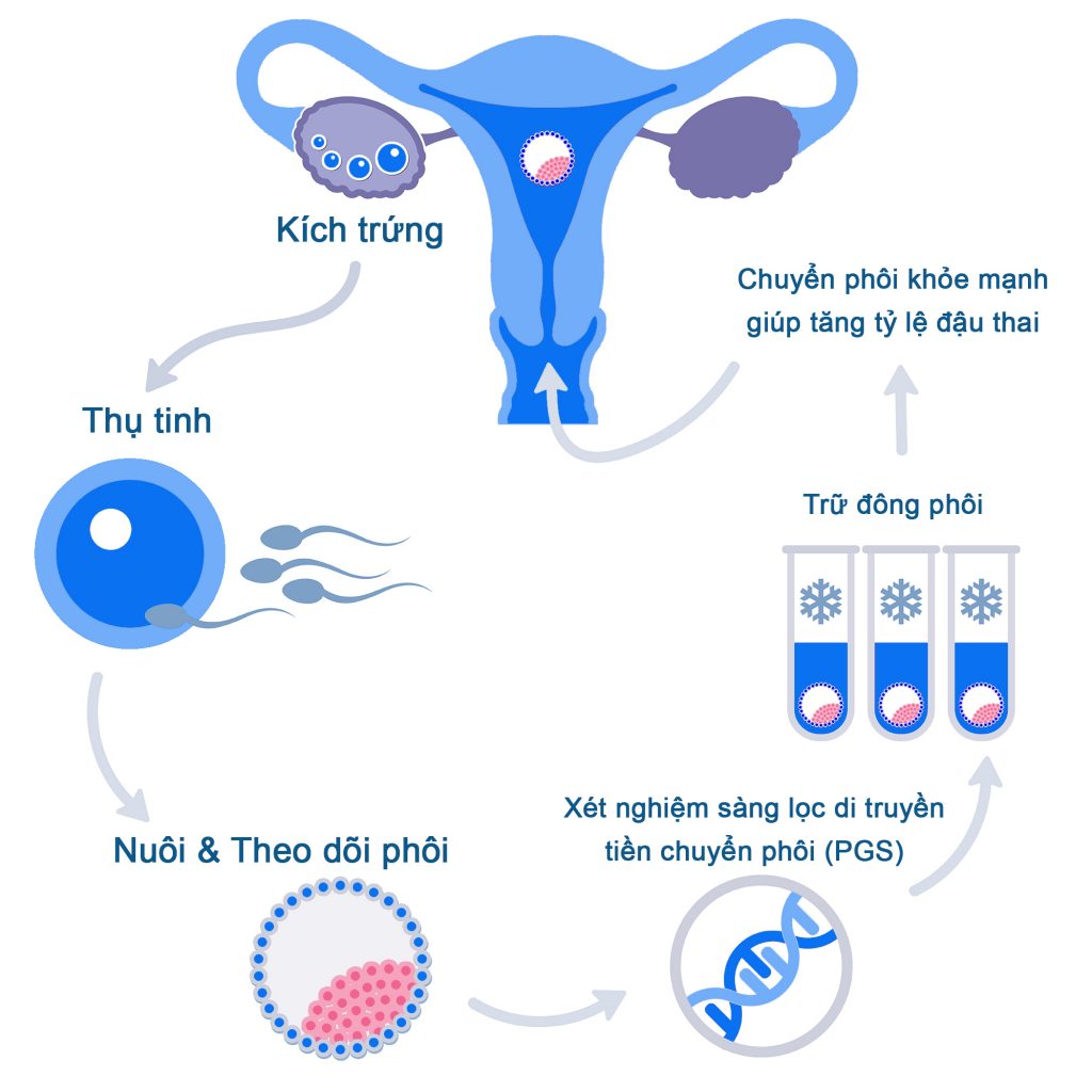 Xét nghiệm sàng lọc tiền chuyển phôi PGS 8 xet nghiem sang loc tien chuyen phoi pgs 3