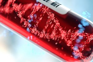 Nguyên nhân gây bệnh Thalasemia là gì?