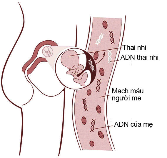 Xét nghiệm NIPT - Sàng lọc cho tương lai 1