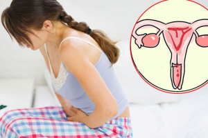 HPV và ung thư cổ tử cung