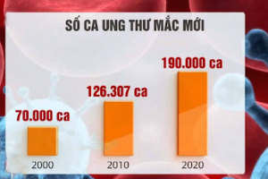 [Cảnh báo] Tình hình ung thư tại Việt Nam
