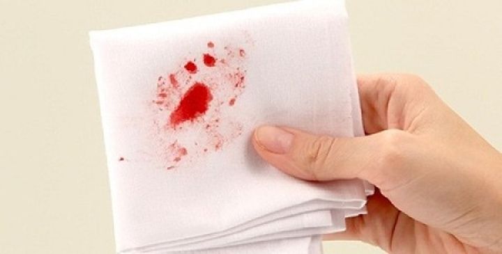 Chảy máu bất thường là dấu hiệu ung thư 