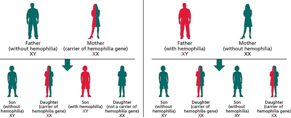 how hemophilia inherited jpeg 3030 3711 1618656566