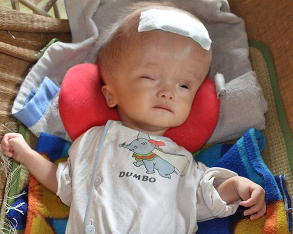 xet nghiem di truyen 5