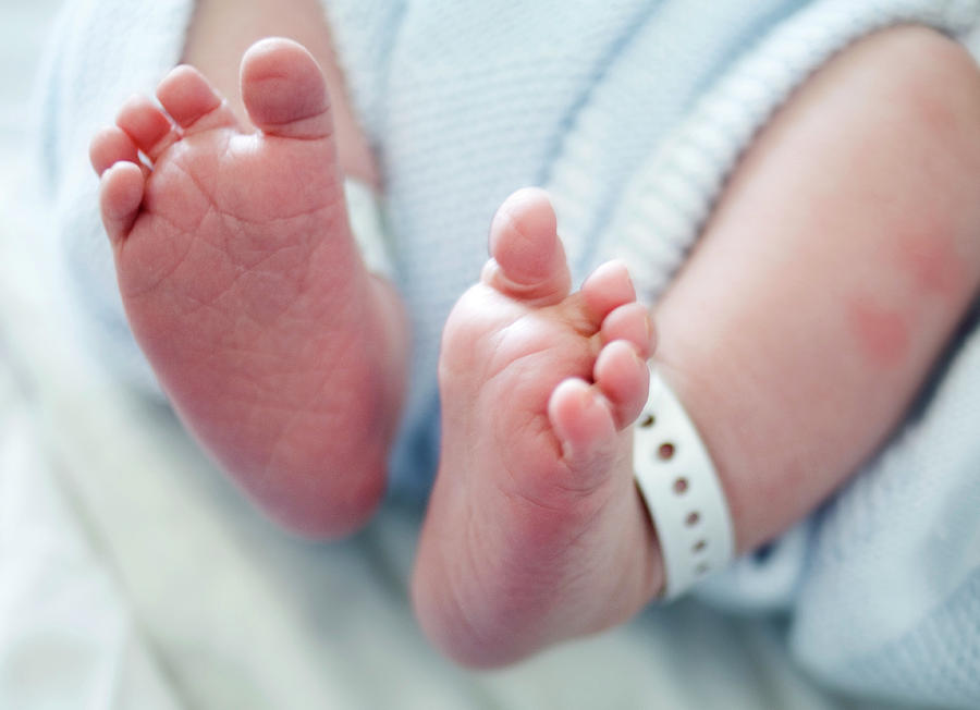 Dị tật bẩm sinh là gì?