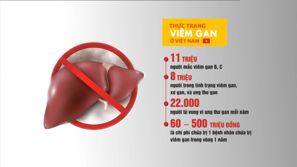 Benh ung thu gan thuong tien trien am tham