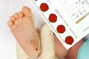 Sàng lọc sơ sinh cho trẻ – đừng bỏ lỡ cơ hội vàng