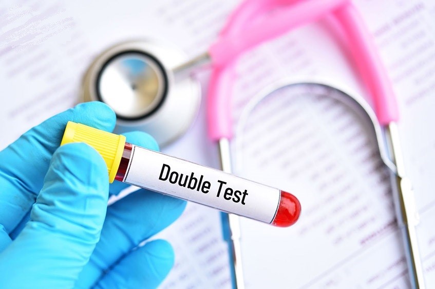 Ket qua Double test nguy co cao can phai lam gi 01