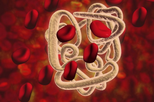 Liệu pháp tế bào gốc trong điều trị bệnh Thalassemia