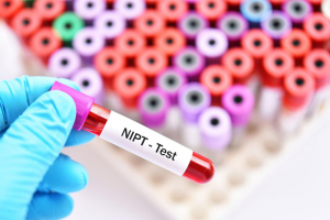 Sàng lọc NIPT- Đánh bay nỗi lo con bị dị tật bẩm sinh