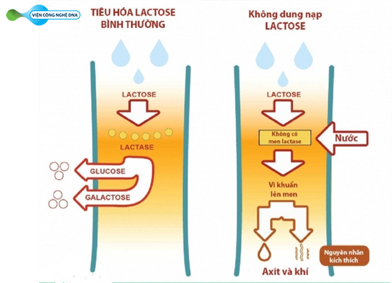 roi loan chuyen hoa Galactose 01