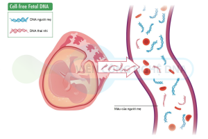 Xét nghiệm NIPT muộn có sao không?