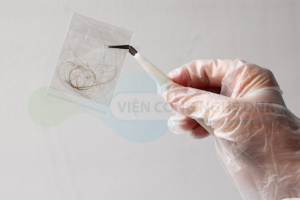 Xét nghiệm ADN bằng tóc có cho kết quả chính xác không?