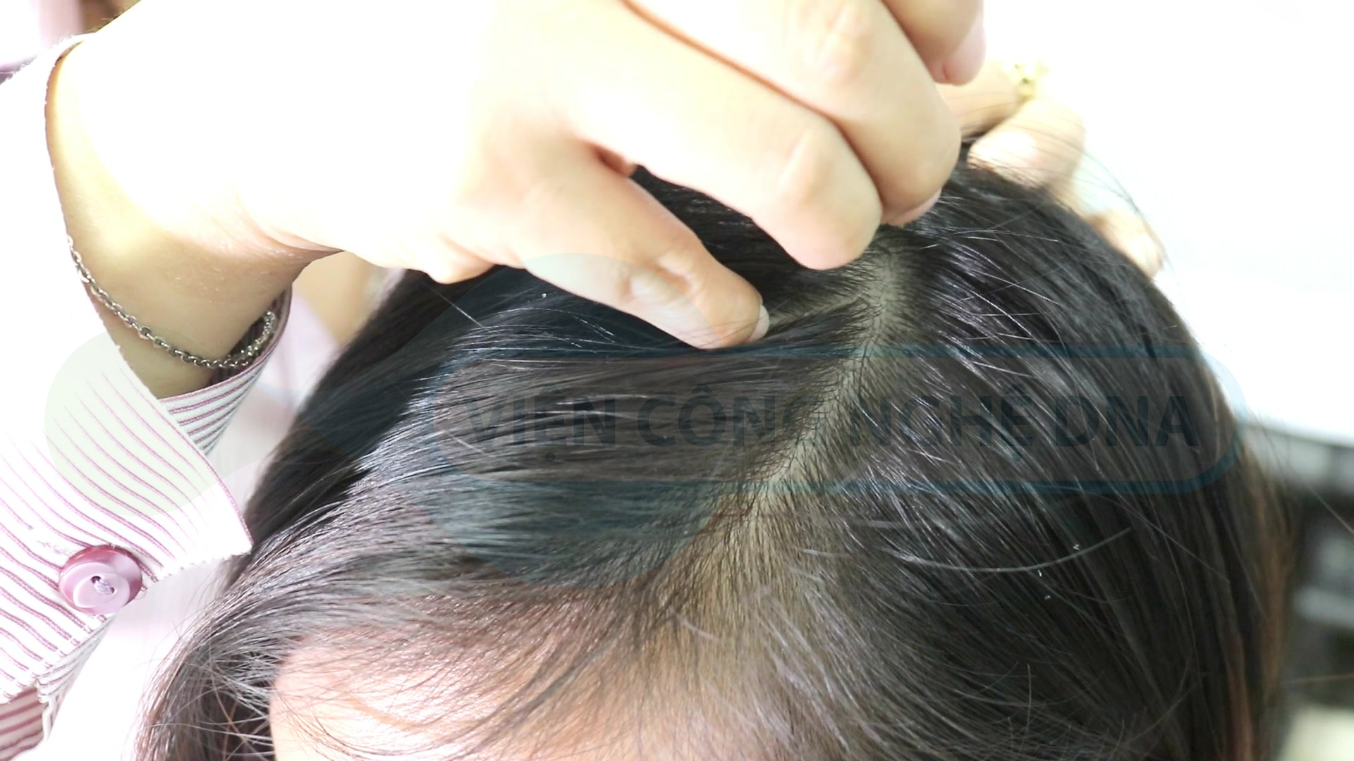 Lưu ý lấy mẫu tóc xét nghiệm ADN đúng yêu cầu
