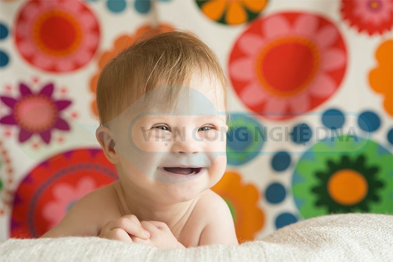 Bố mẹ cao tuổi dễ sinh ra những em bé mắc Hội chứng Down