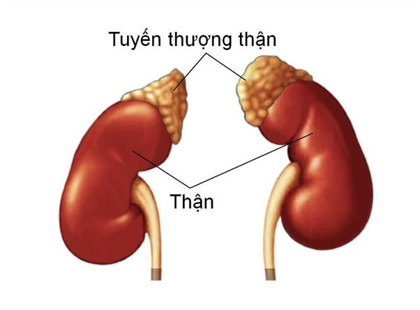 Sàng lọc sơ sinh có thể phát hiện bệnh tăng sinh tuyến thượng thận bẩm sinh