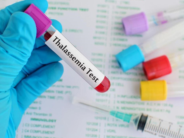 Bà bầu mắc bệnh Thalassemia nên làm sàng lọc trước sinh để biết thai nhi có mắc bệnh hay không