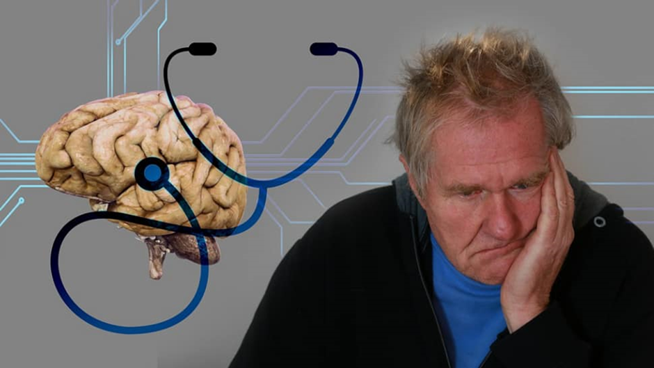 Alzheimer co phai la benh di truyen khong 01