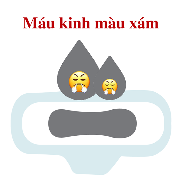 Máu kinh màu xám có thể cảnh báo tình trạng viêm âm đạo do vi khuẩn