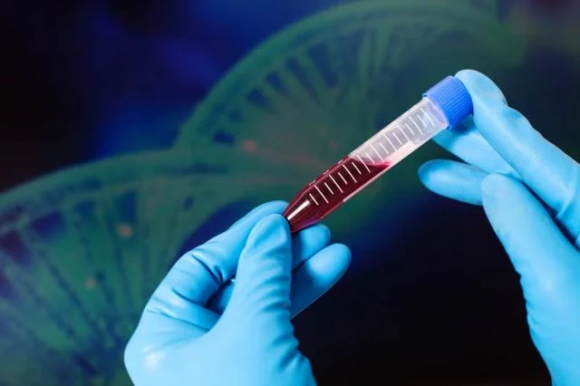 Benh hemophilia A chung mau kho dong thuong gap nhat 01