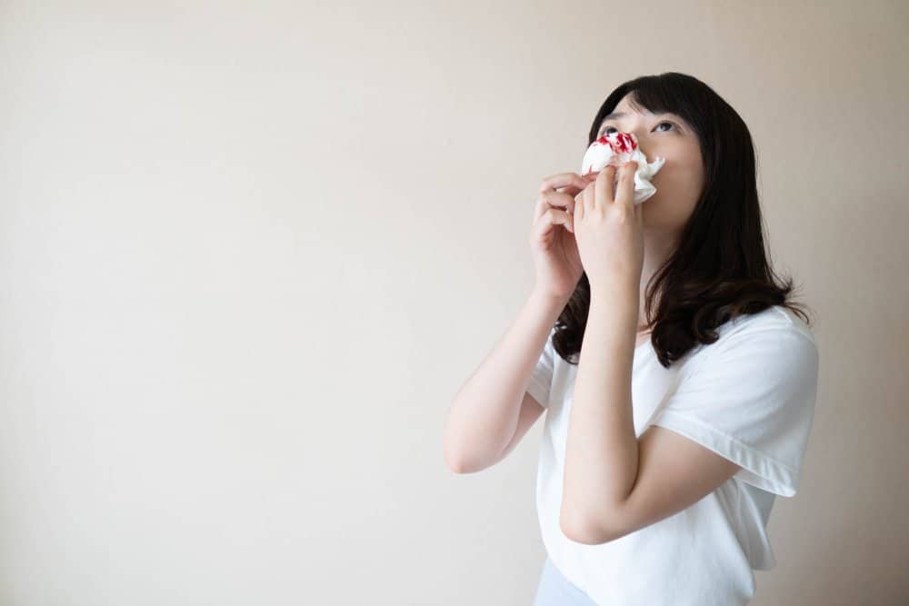 Benh hemophilia A chung mau kho dong thuong gap nhat 02
