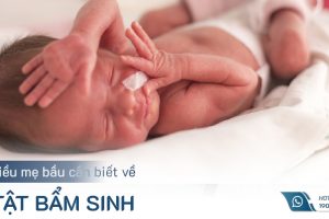 [Kiến thức] 99 điều cần biết về dị tật bẩm sinh ở trẻ