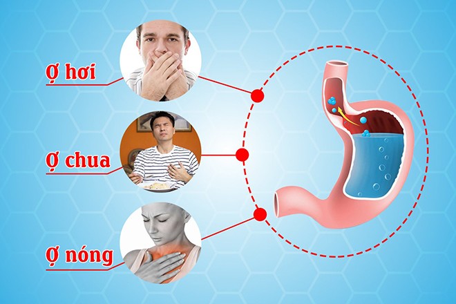 Pho Giam doc Benh vien K chi ro dau hieu canh bao som ung thu da day d day 2 1700531674 417 width660height440