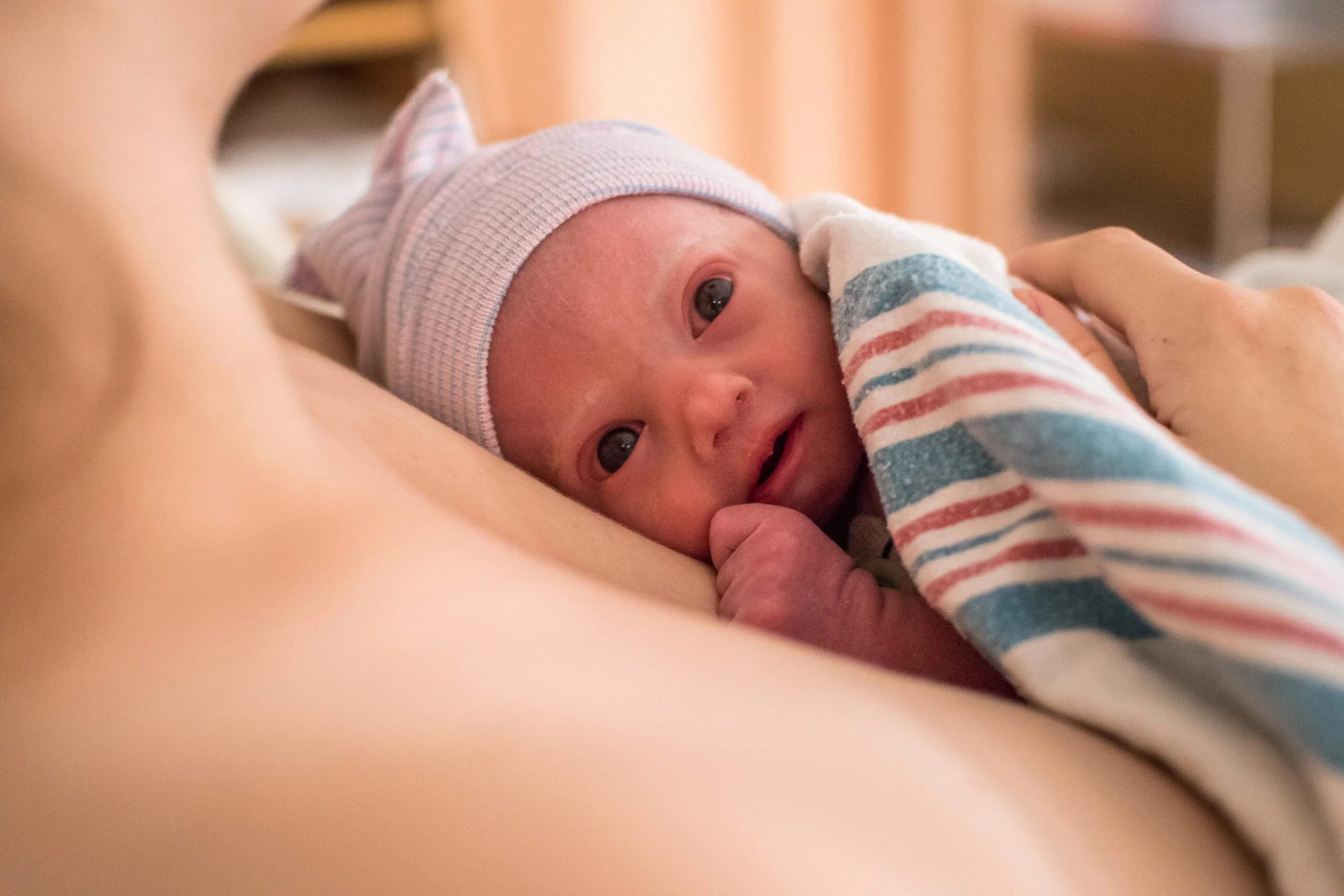 trisomy 18 hay hoi chung edwards la gi scaled 1