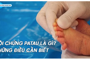 Hội chứng Patau là gì? Những điều cần biết