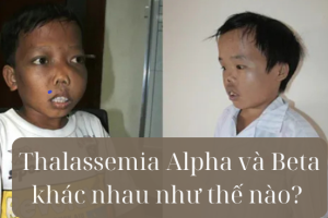 Thalassemia Alpha và Beta khác nhau như thế nào? 