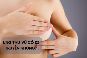 Ung thư vú có di truyền không? 